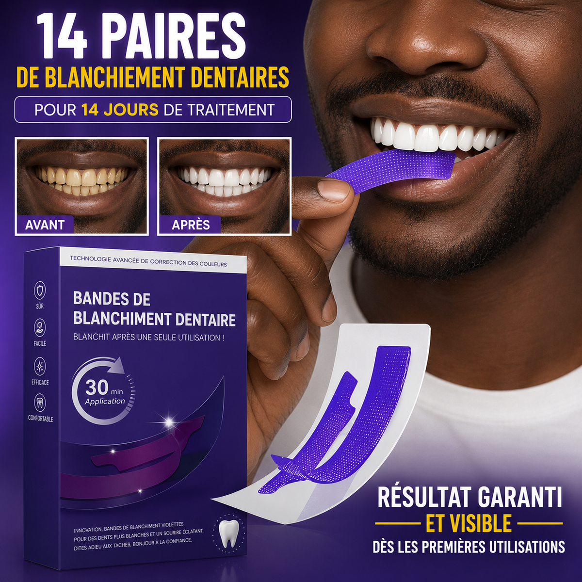 Bandes de blanchiment dentaire V34